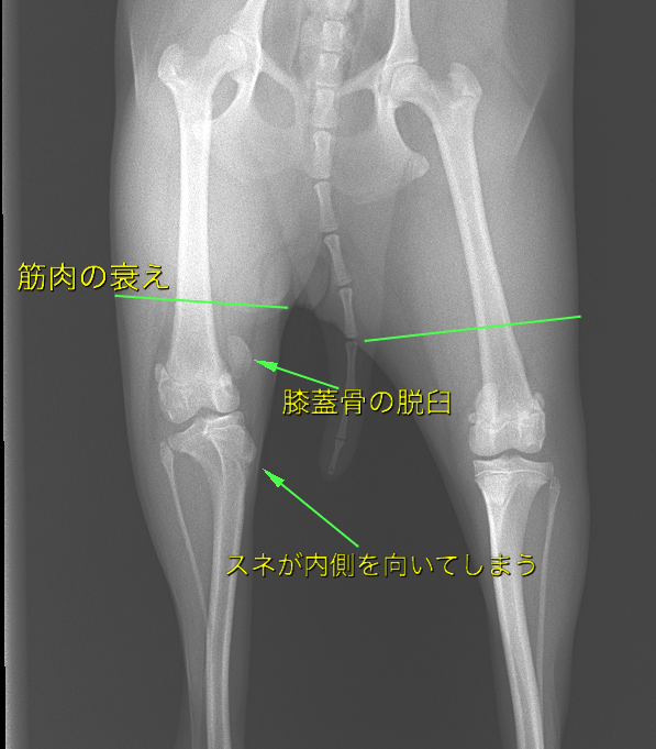 グレード４