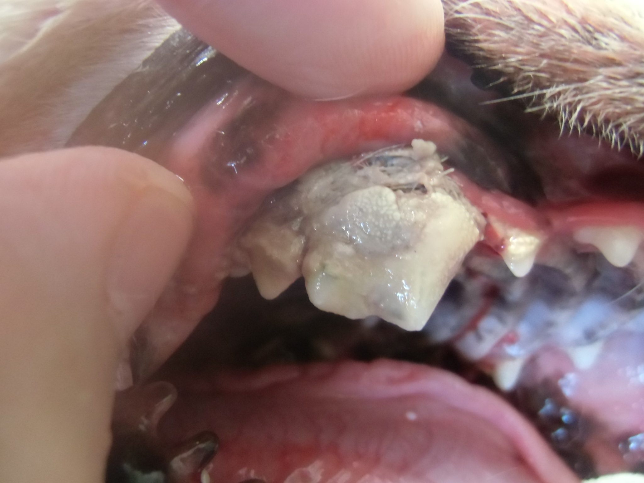 第４前臼歯歯石