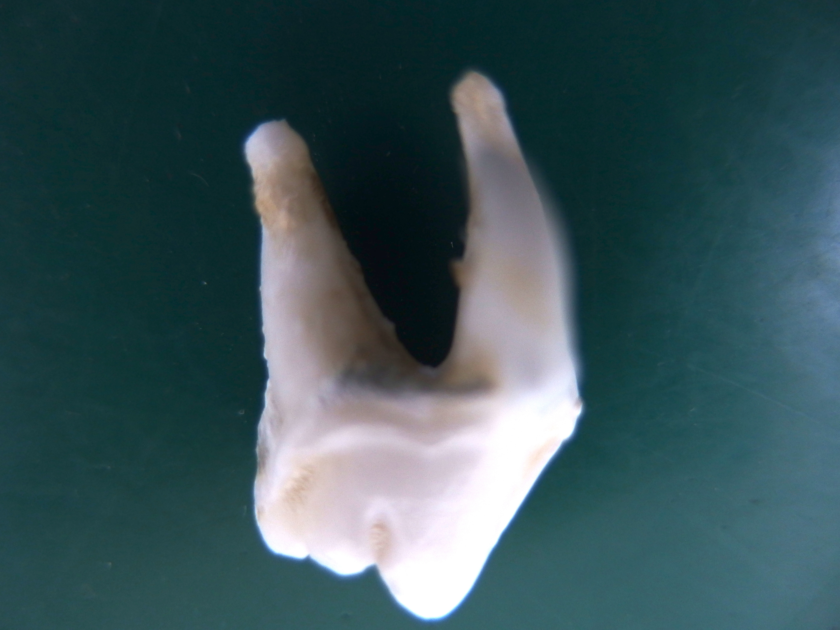 第４前臼歯