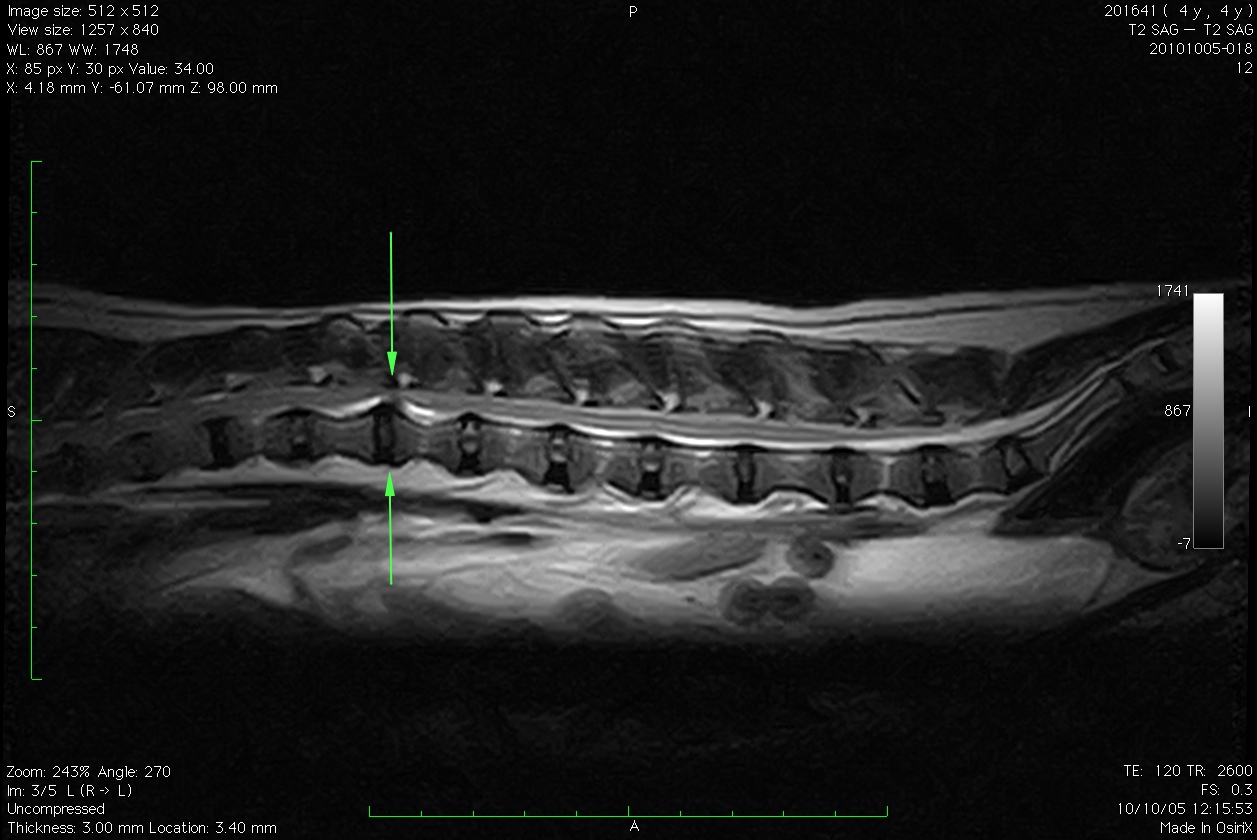 犬　椎間板ヘルニア　MRI画像