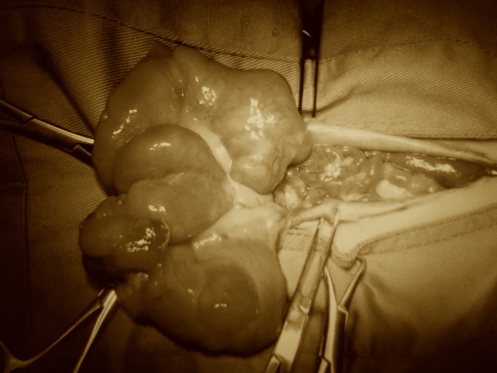 ウサギ　子宮腺癌　手術