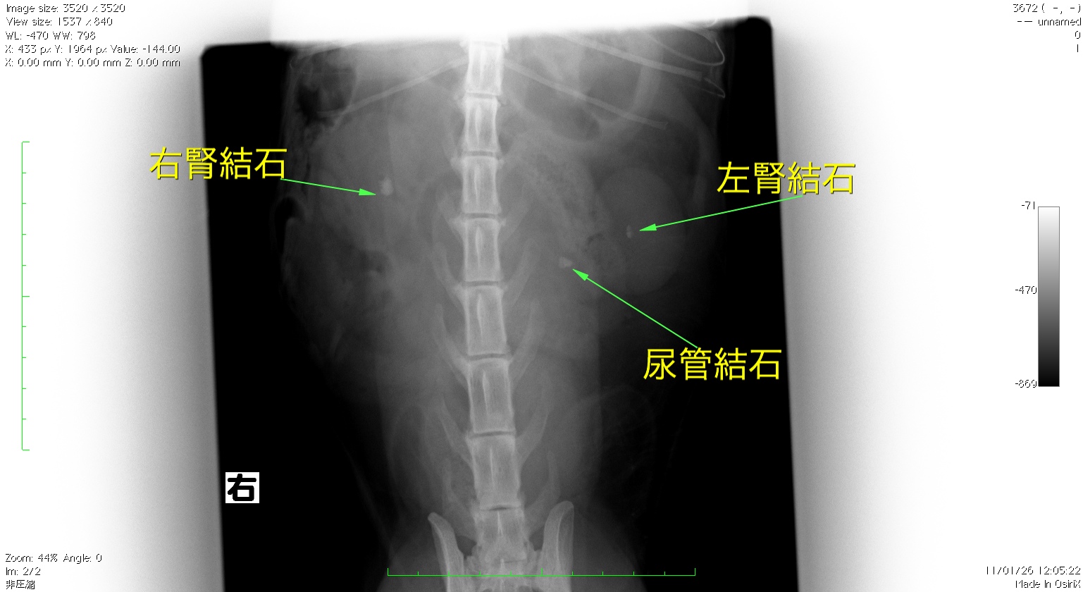 猫　尿管結石